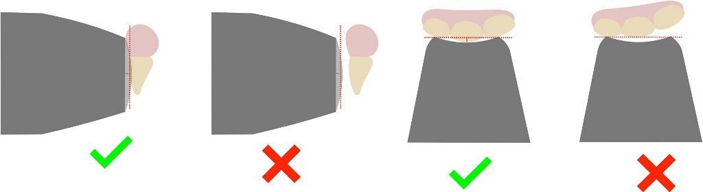 Digital determination of tooth shades : practical application of modern 10