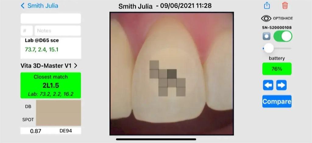 Digital determination of tooth shades: practical application of modern colorimeter21