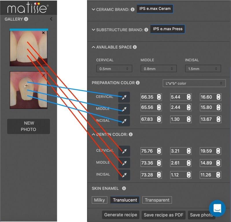 Digital determination of tooth shades: practical application of modern colorimeter24