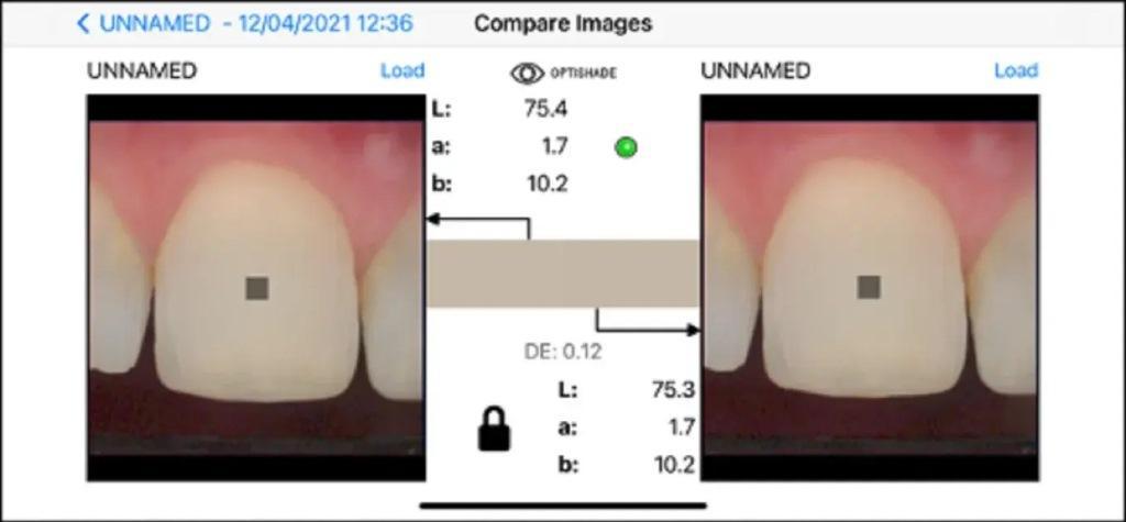 Digital determination of tooth shades : practical application of modern 11