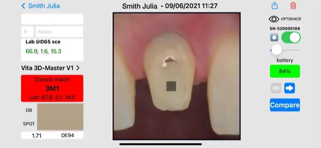 Digital determination of tooth shades: practical application of modern colorimeter23