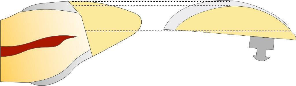 Digital determination of teeth shades : practical application of a modern colorimeter4