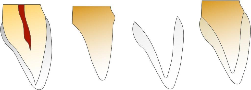 Digital determination of tooth shades : practical application of modern 17