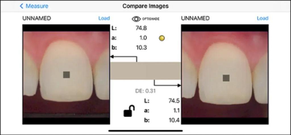 Digital determination of teeth shades : practical application of modern 13