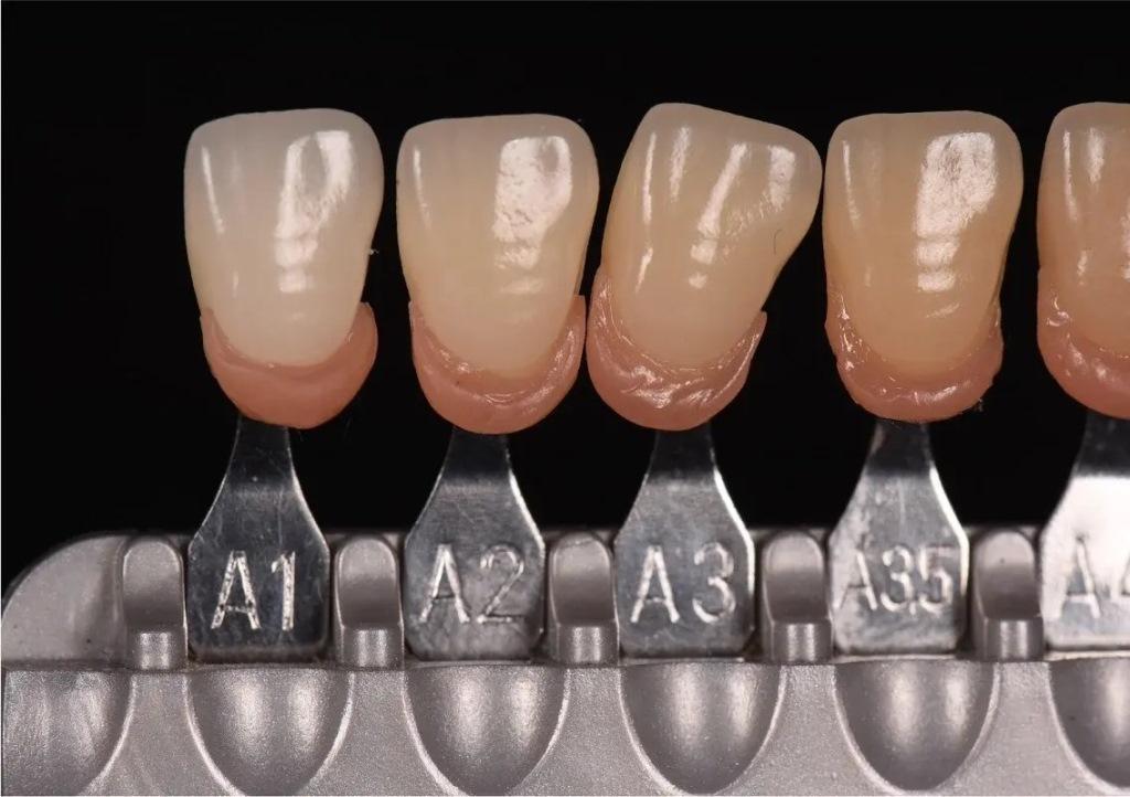 Digital determination of tooth shades: practical application of modern colorimeter1