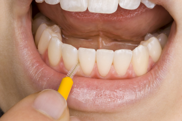 Research shows that interdental brushes and rubber toothpicks are the most effective devices