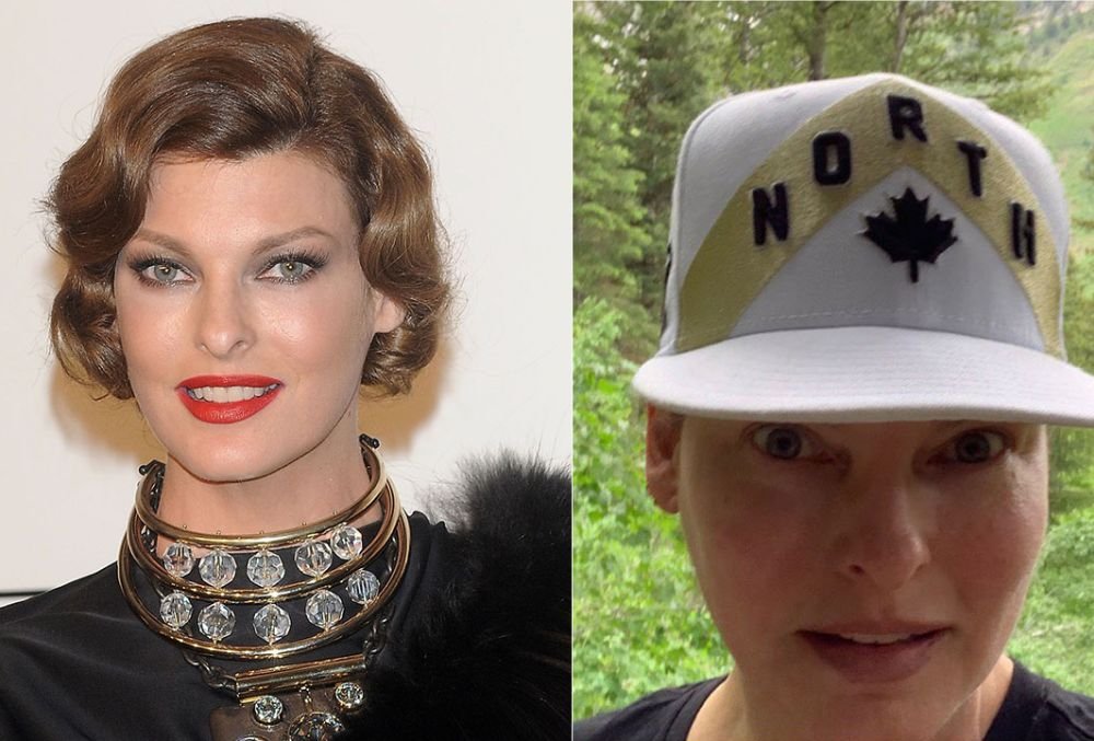 Plastic surgeons mutilated Linda Evangelista