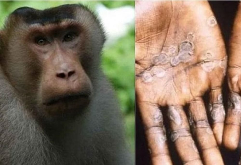 Russians are not so afraid of monkeypox