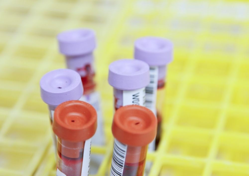 Rapid blood test will reveal liver disease