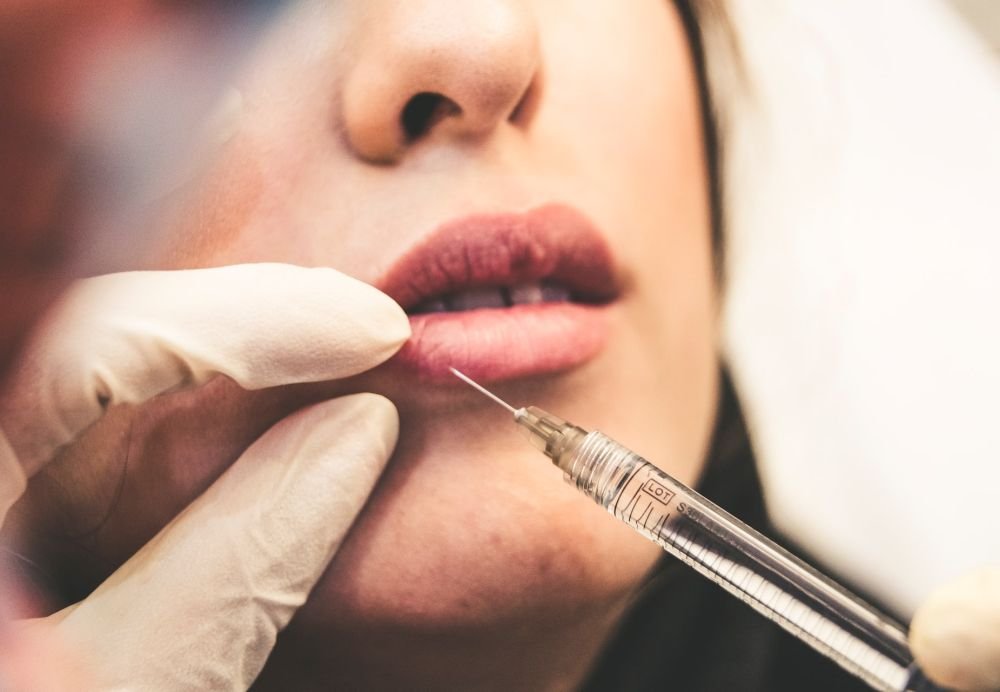 Lip fillers must be given by prescription