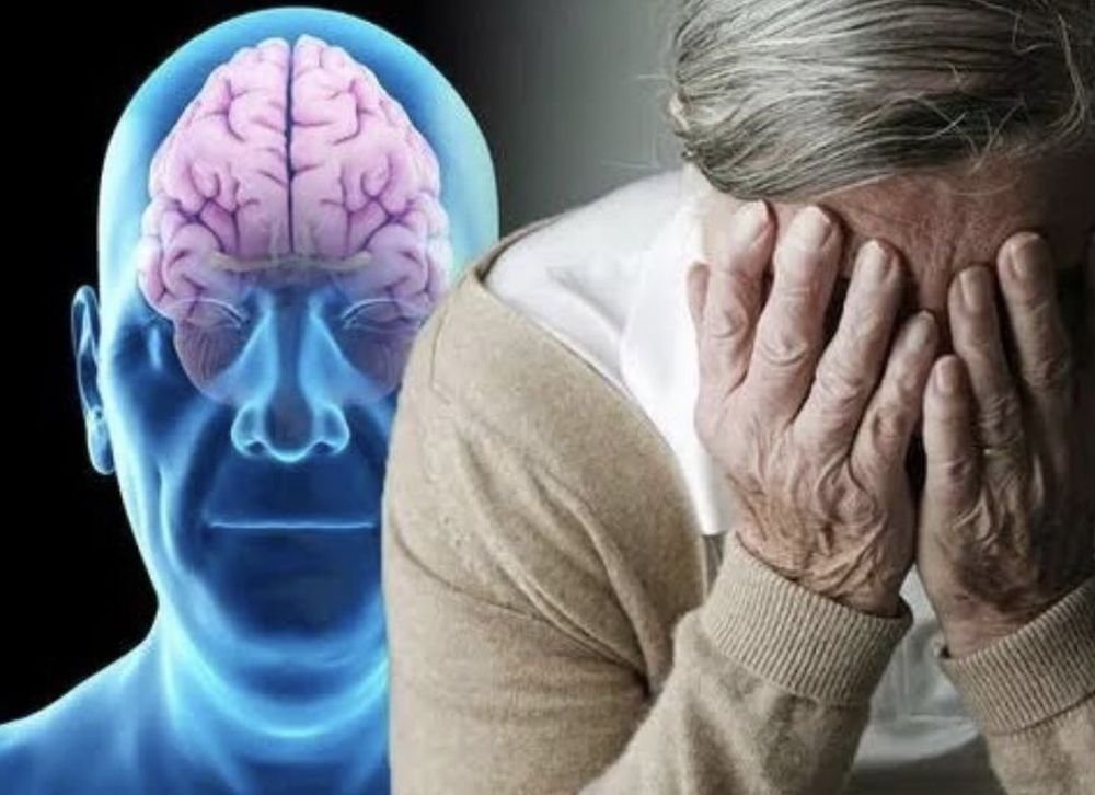 Found a protein that protects against dementia