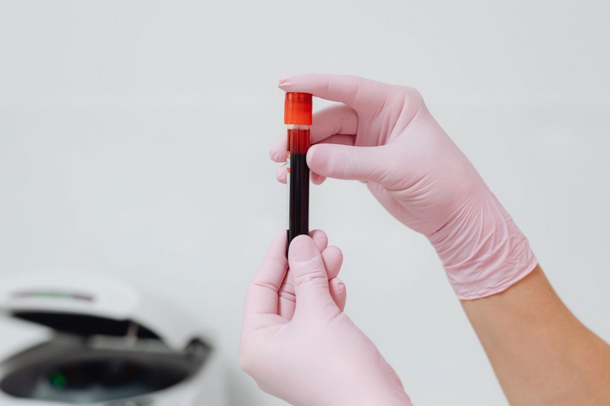 One simple blood test indicates your risk of a heart attack - cardiologist Varfolomeev