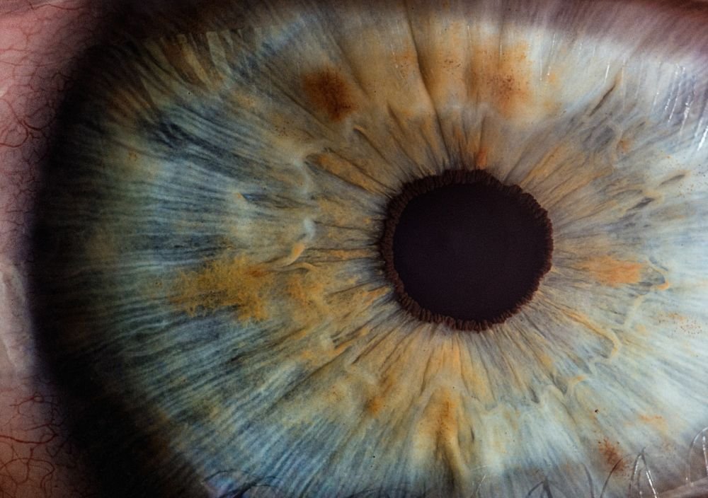 Injecting genes into the eyes will stop vision loss