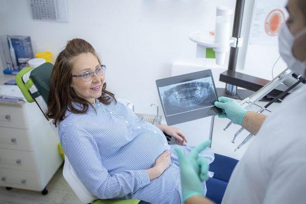 What you need to know about X-rays during pregnancy