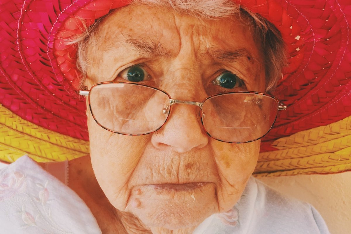 Yellow deposits around the eyes are a symptom of high cholesterol