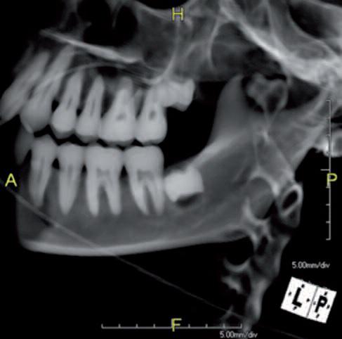 Forensic dentistry: more than just identification8