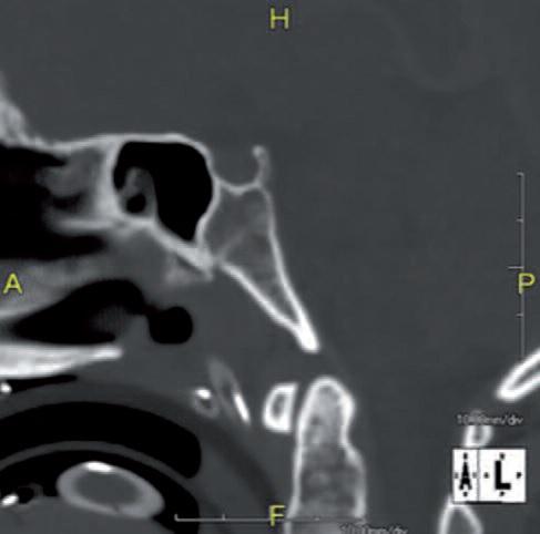 Forensic dentistry: more than just identification9