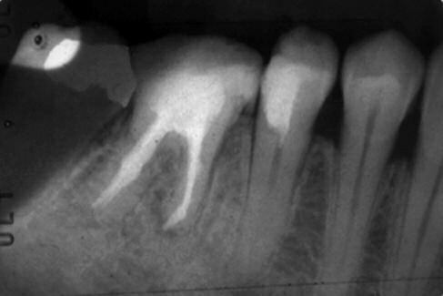 Forensic dentistry: more than just identification3