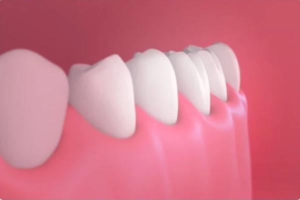 The study revealed an important cellular activity in gum tissue