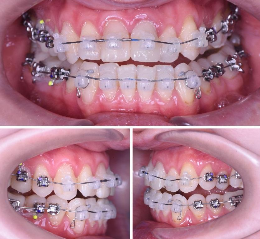 Complex approach in dentistry4