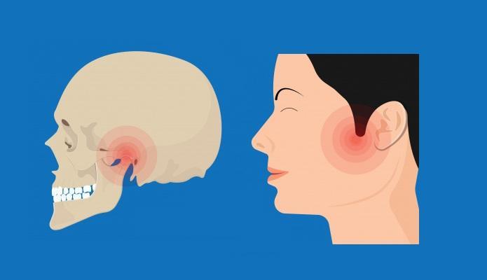 The main factor in TMJ non-resolution is a high pain intensity