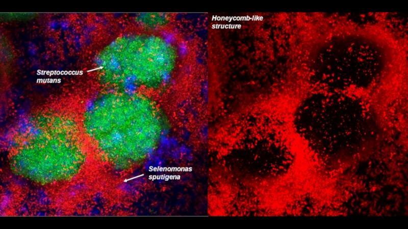 Research reveals new species of bacteria involved in the formation of dental caries1