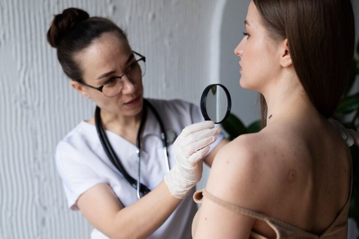 a doctor checks a patient's mole