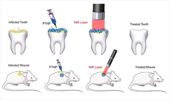 An excellent way to fight bacteria oral cavity will help reduce the use of antibiotics1