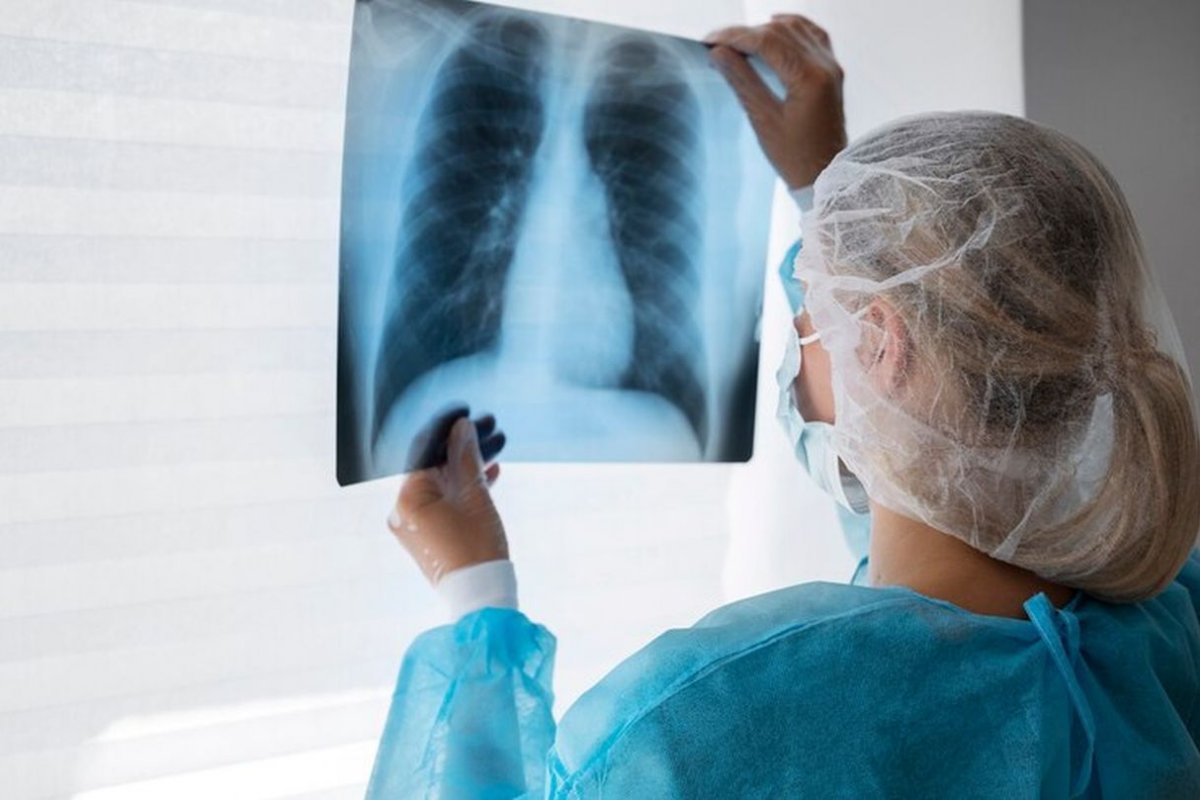 a photo of the lungs in the hands of a doctor