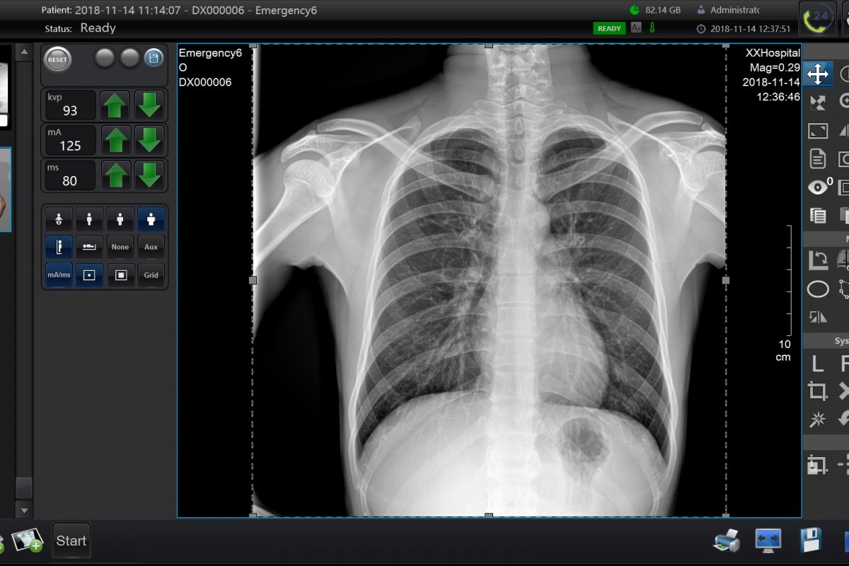 X-ray detectors: what types are there and how to choose the right model