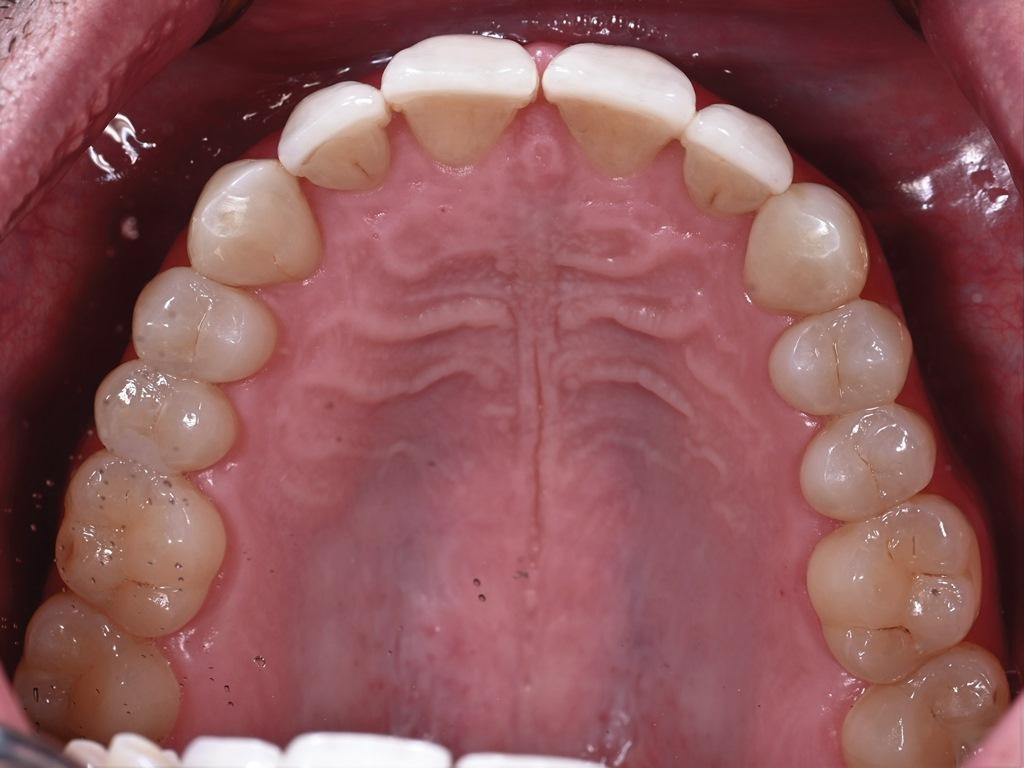 Sleep Disordered Breathing and Its Potential Impact in the Field of Therapeutic Dentistry (A 14-Year Case Study)10