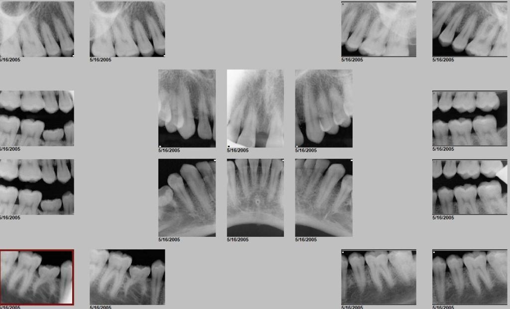 Sleep Disordered Breathing and Its Potential Impact in the Field of Therapeutic Dentistry (A 14-Year Case Study)4