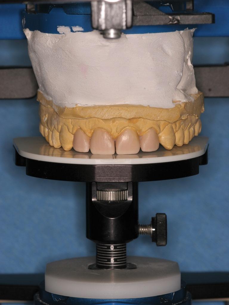 Sleep Disordered Breathing and Its Potential Impact in the Field of Therapeutic Dentistry (A 14-Year Case Study)5