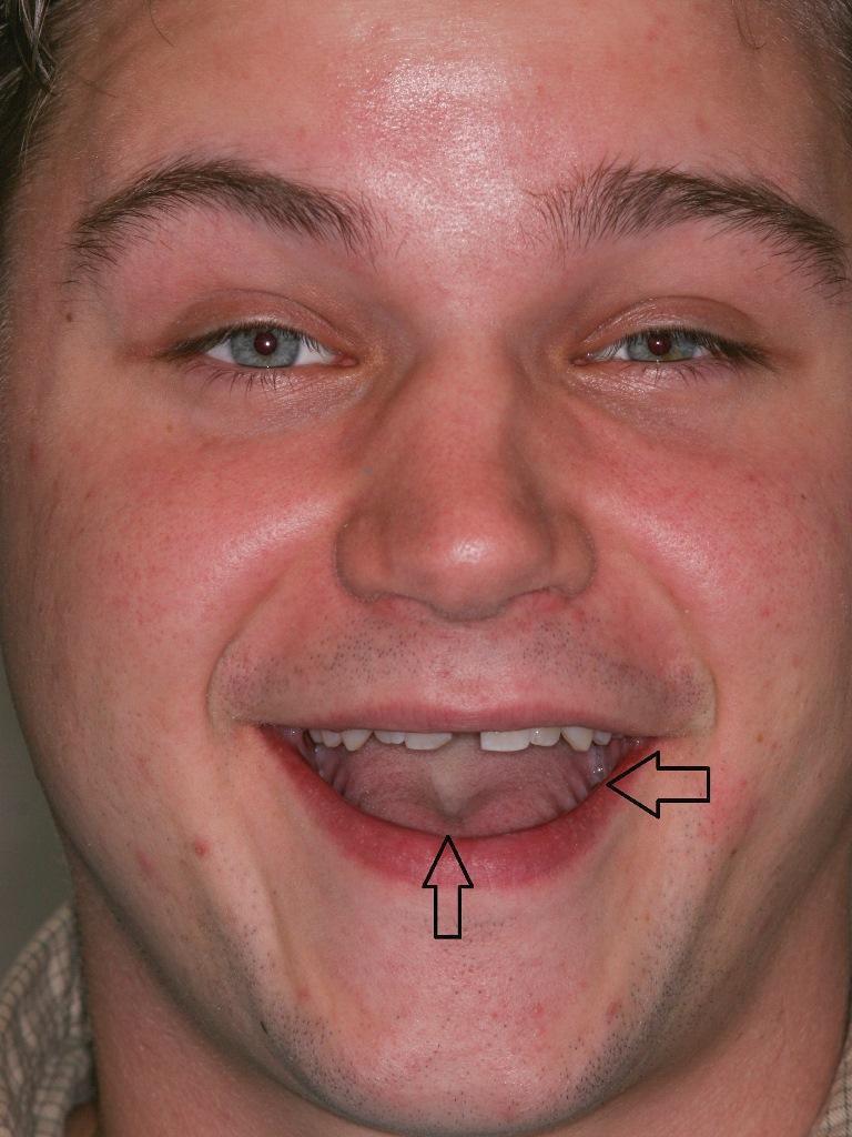 Sleep Disordered Breathing and Its Potential Impact in the Field of Therapeutic Dentistry (A 14-Year Case Study)16