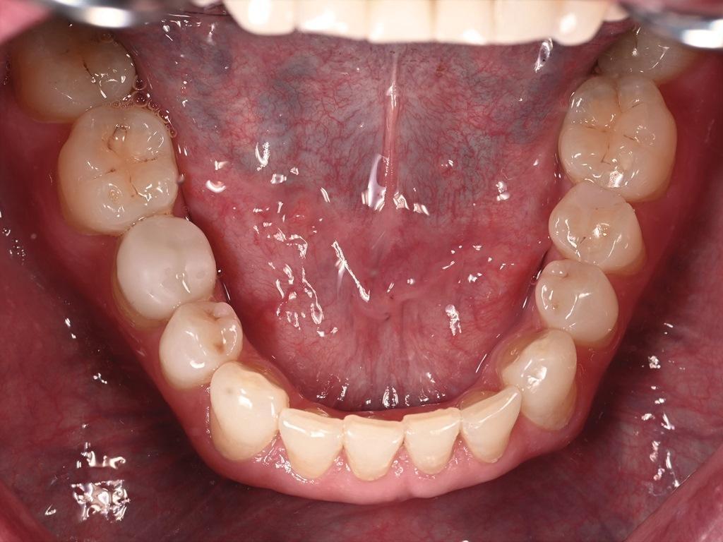 Sleep Disordered Breathing and Its Potential Impact in the Field of Therapeutic Dentistry (A 14-Year Case Study)11