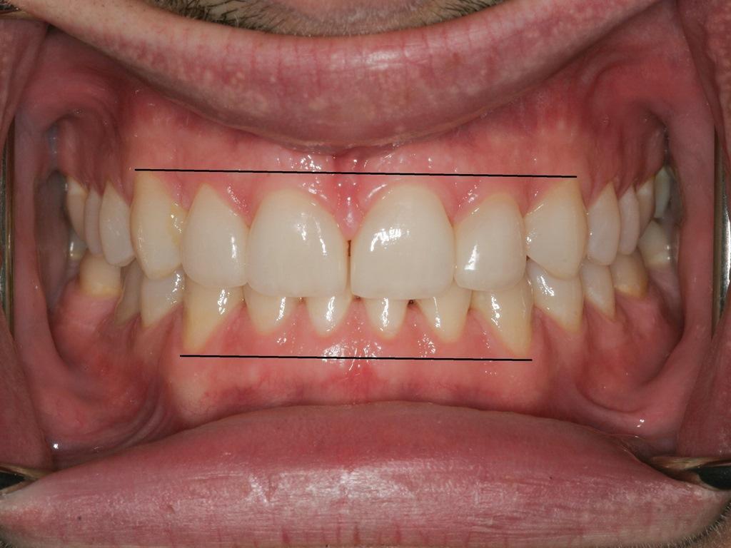 Sleep Disordered Breathing and Its Potential Impact in the Field of Therapeutic Dentistry (A 14-Year Case Study)7