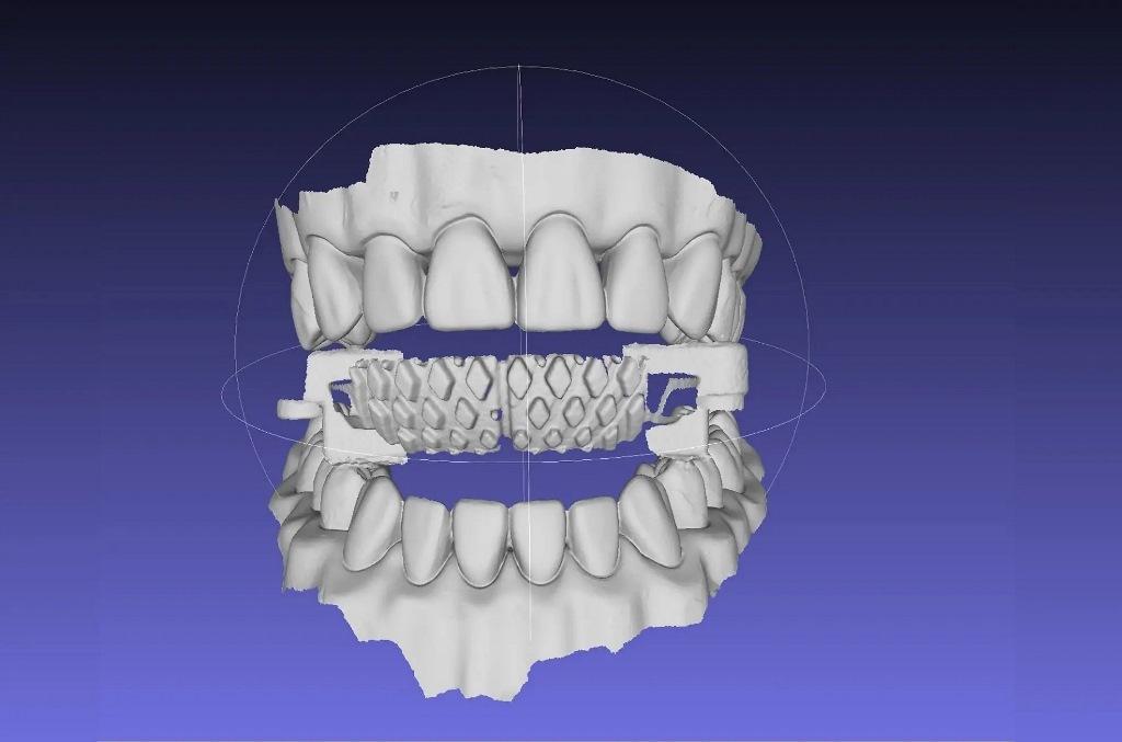 The Proclaim device is a new solution for individual oral hygiene at home4