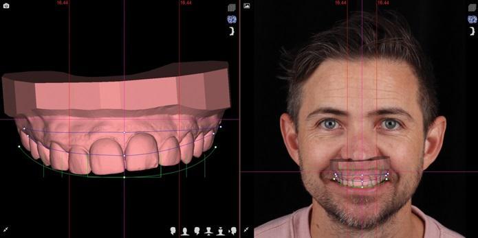 The impact of digital dentistry on the implementation of complex aesthetic treatment by dentists of different specialties2