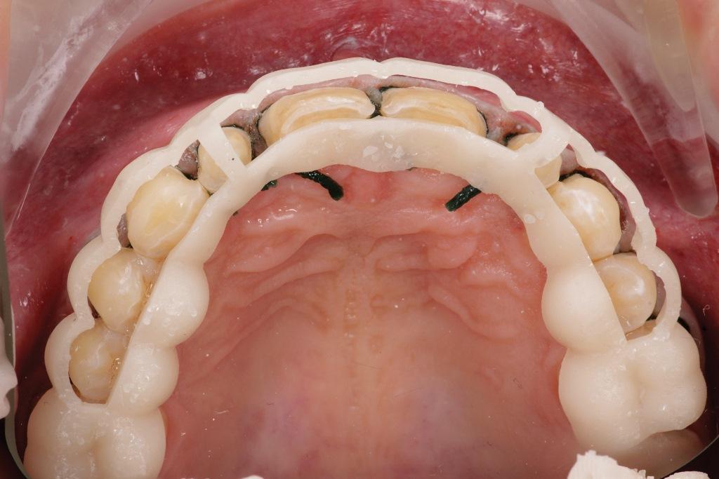 The Impact of Digital Dentistry on the Implementation of Comprehensive Esthetic Treatment by Dentists of Different Specialties21