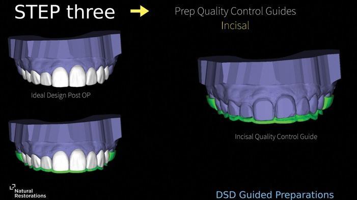 The impact of digital dentistry on the implementation of complex aesthetic treatment by dentists of different specialties13