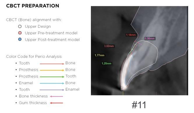 The impact of digital dentistry on the implementation of complex aesthetic treatment by dentists of different specialties4