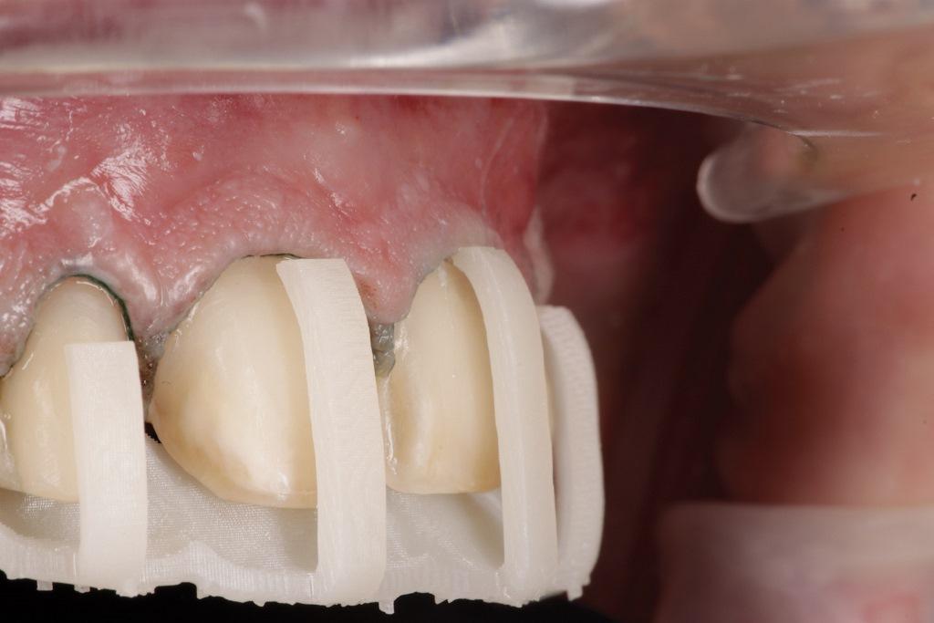 The Impact of Digital Dentistry on the Implementation of Comprehensive Esthetic Treatment by Dentists of Different Specialties20