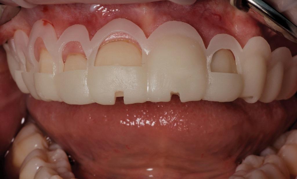 The impact of digital dentistry on the implementation of complex aesthetic treatment by dentists of different specialties5