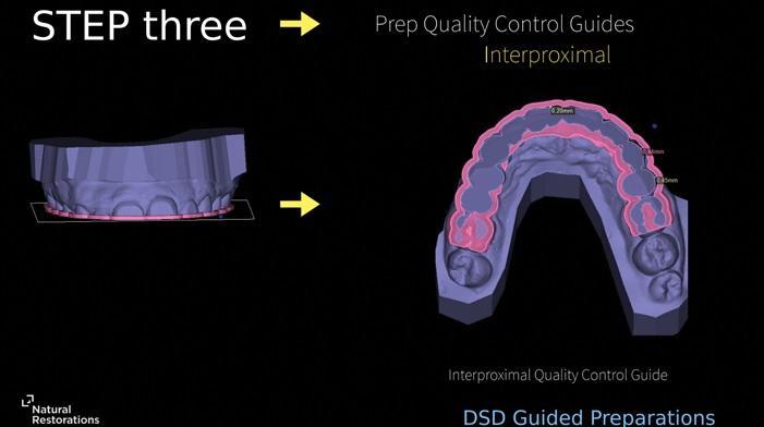 The influence of digital dentistry on the implementation of complex aesthetic treatment by dentists of different specialties17