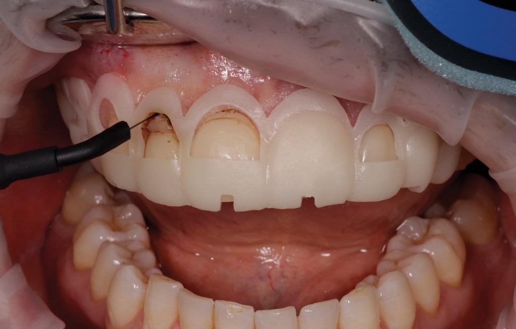 The Impact of Digital Dentistry on the Implementation of Comprehensive Esthetic Treatment by Dentists of Different Specialties6