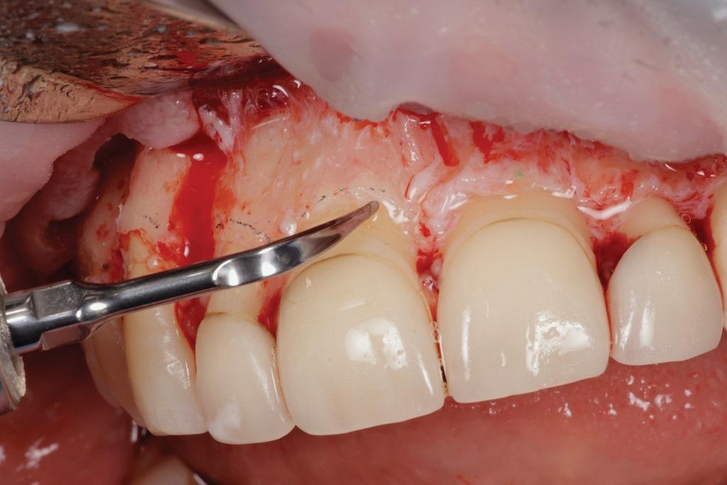 The influence of digital dentistry on the implementation of complex aesthetic treatment by dentists of different specialties7