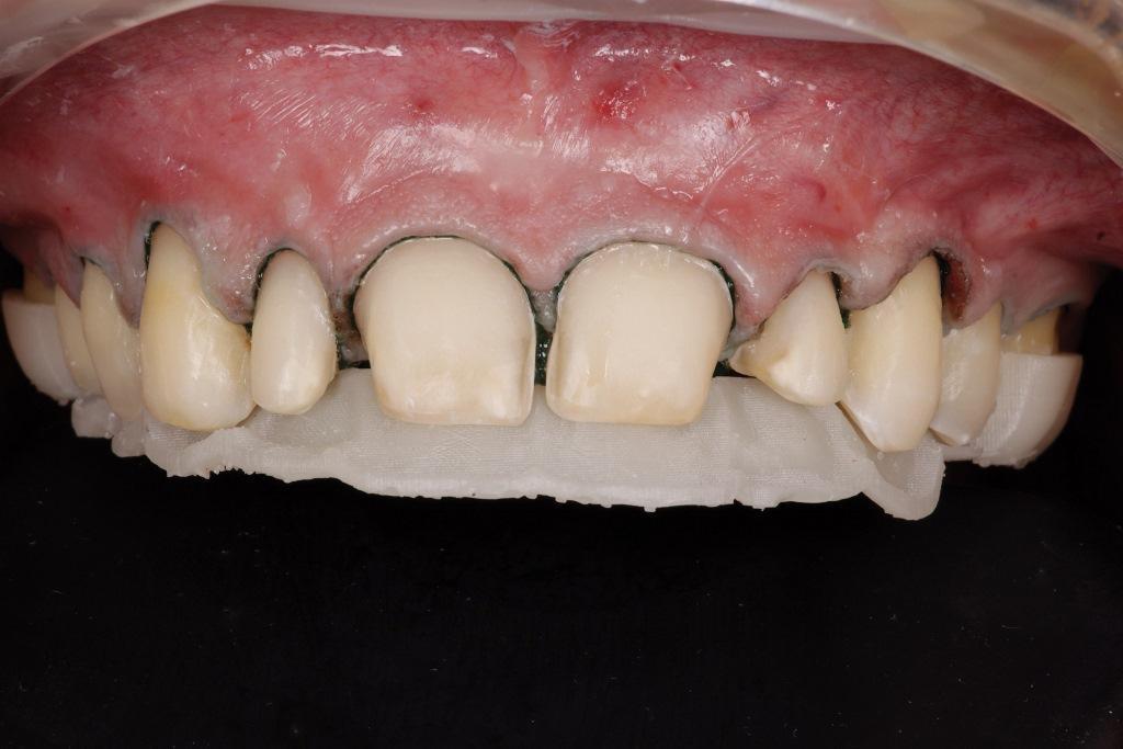 The Impact of Digital Dentistry on the Implementation of Comprehensive Esthetic Treatment by Dentists of Different Specialties19