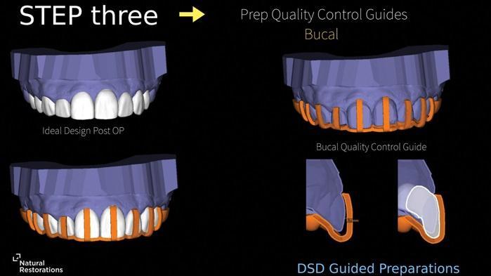 The influence of digital dentistry on the implementation of complex aesthetic treatment by dentists of different specialties15