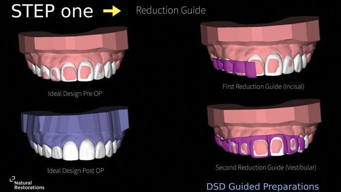 The influence of digital dentistry on the implementation of complex aesthetic treatment by dentists of different specialties11