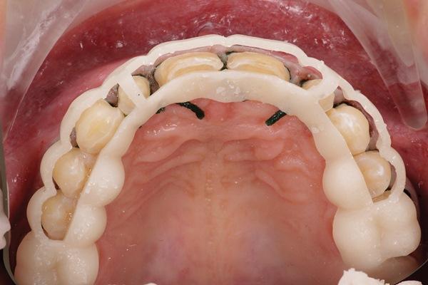 The impact of digital dentistry on the implementation of complex aesthetic treatment by dentists of different specialties